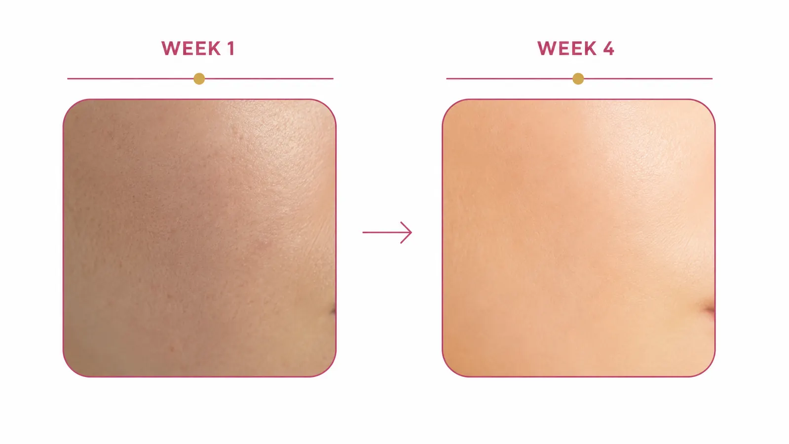Side-by-side comparison of dull uneven skin tone versus brighter even complexion after consistent serum use